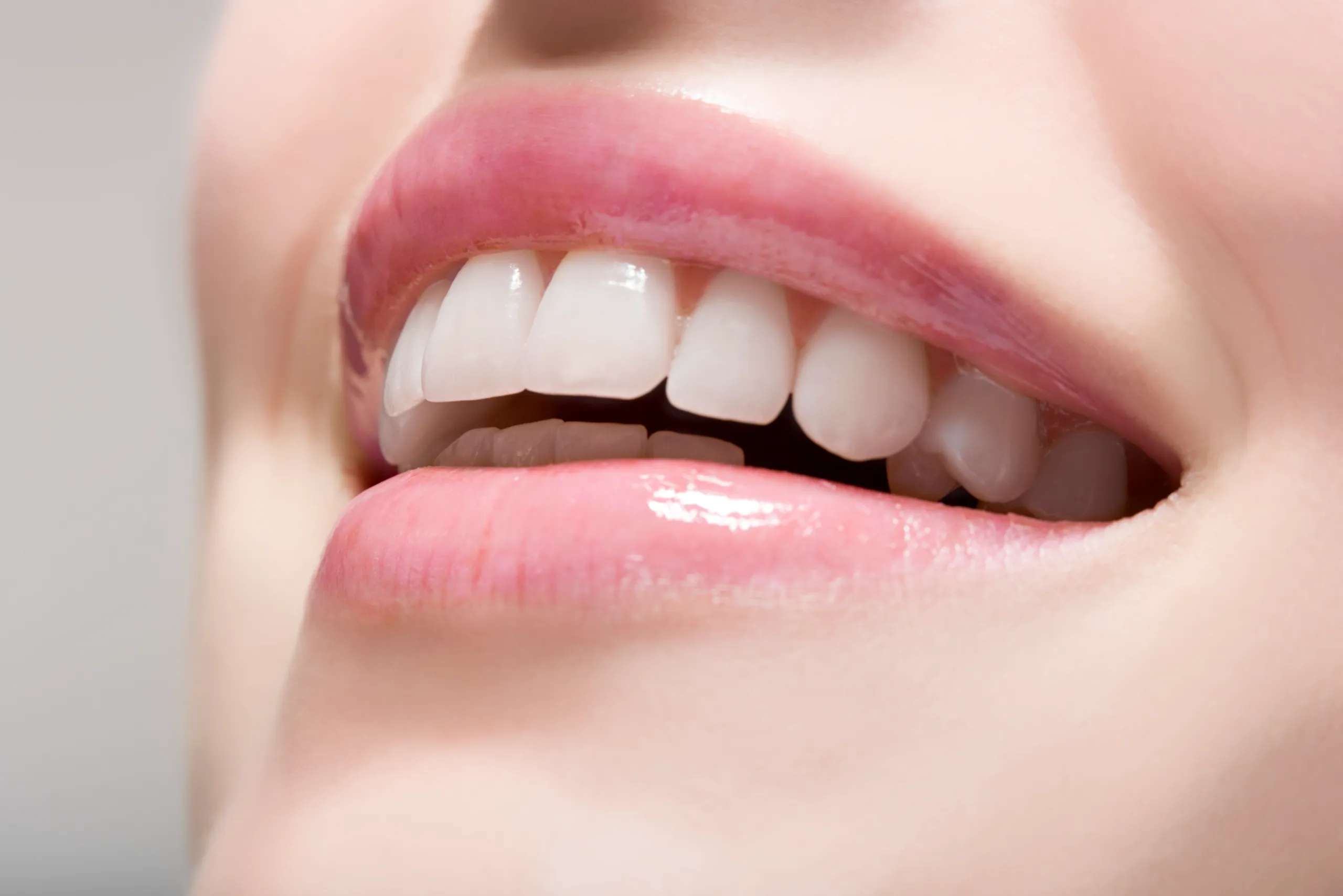 Laser Teeth Whitening FAQs Dundee