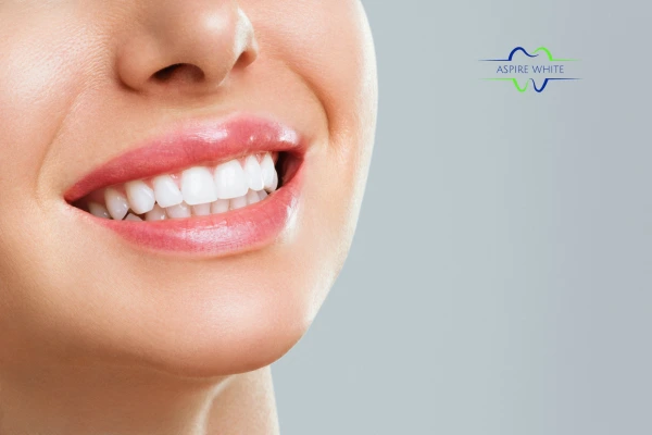 Safe and effective laser whitening treatment for visibly whiter teeth Dundee