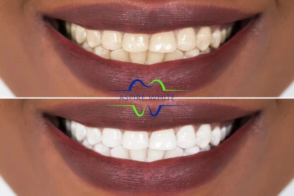 Side-by-side comparison showing before and after results of a cosmetic treatment Dundee